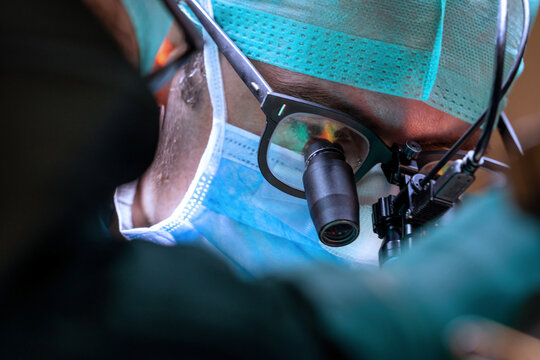 Surgeons wear magnifying glasses in the operating room. Intraoperative magnification using surgical magnifying loupes in the areas of microsurgery, plastic, cardiac neurosurgery, organ transplant