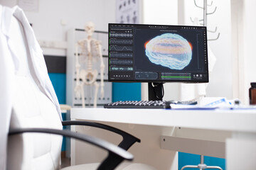 Unoccupied desk with computer screen displaying brain imaging data in doctors office. Modern pc monitor showing radiology results of human head highlighting use of advanced technology in hospital.