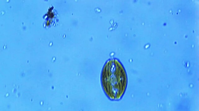Amphora ovalis, diatom under microscope - 400X