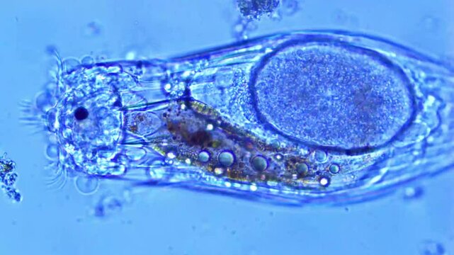 Notholca Spp. - Rotifer under microscope - 400X