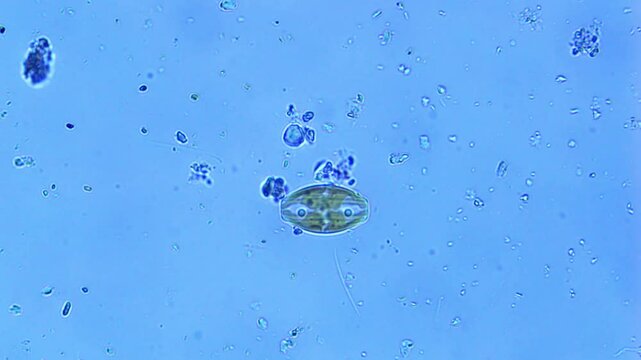 Amphora ovalis diatom under the microscope - 400X