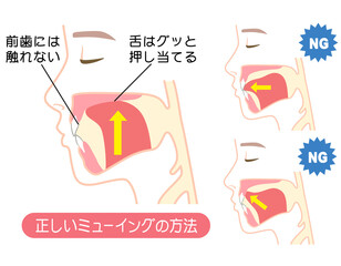 正しいミューイングの方法　適正な舌の位置と誤った舌の位置 © koti
