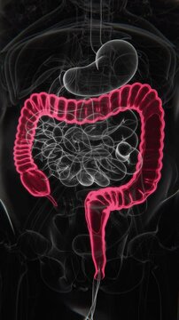 Ulcerative Colitis Indication X-ray in Vertical Video | Ulcerative Colitis X-ray in Vertical HQ Video