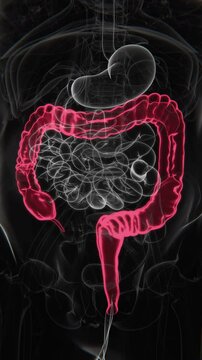 Crohn&rsquo;s Disease Indication X-ray in Vertical Video | Crohn&rsquo;s Disease X-ray in Vertical HQ Video