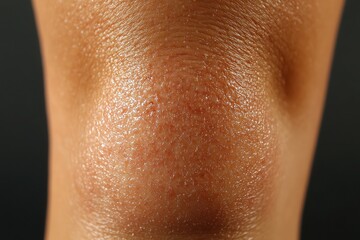 Fototapeta premium Close-up of a dry and rough knee, textured skin reflecting dehydration, lack of moisture, skincare concern, health awareness, and personal care needs in daily hygiene.