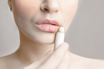 Woman dyes her lips with moisturizing balm. Woman with dry lips, dry skin problem. Close up photo