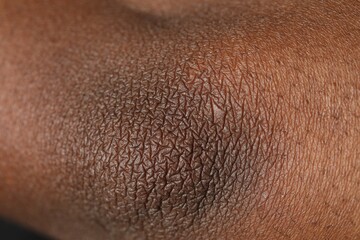 Fototapeta premium Macro view of normal skin as background