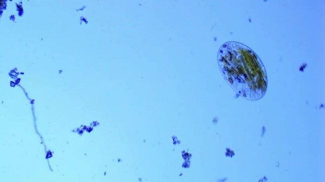 Frontonia, unicellular ciliate protist, in freshwater under microscope - 400X