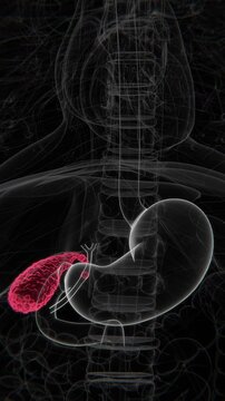 Cholecystitis Indication X-Ray Video | Gallbladder Infection in Vertical HQ X-Ray Video