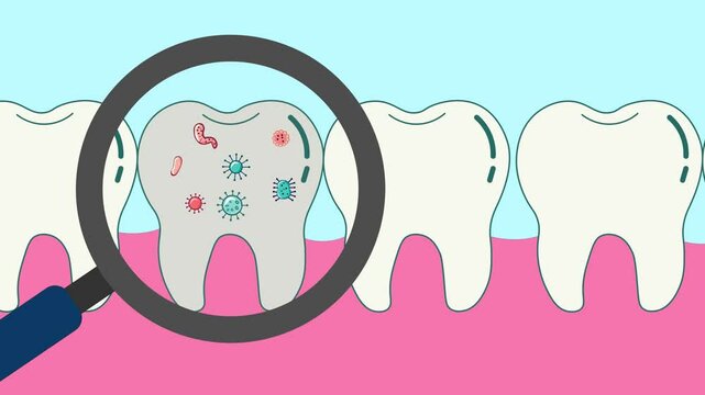 Tooth Infection Under the Lens, Bacteria and Inflammation in Focus. A cartoon-style animation of magnifying glass zooming in on infected Tooth, oral infections, diagnosis of tooth decay
