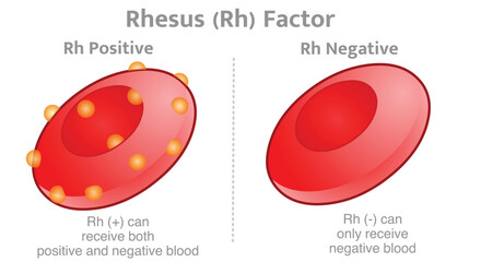 Rhesus factor anatomy, Rh positive + negative - versus. Rh factor, is a certain type of protein found on the outside of red blood cells. Vector illustration