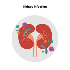 Kidney infection urology urinary problem. Medical diagram 