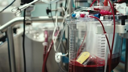 Close-up of an artificial circulation device during heart surgery. Concept of advanced medical technologies. 