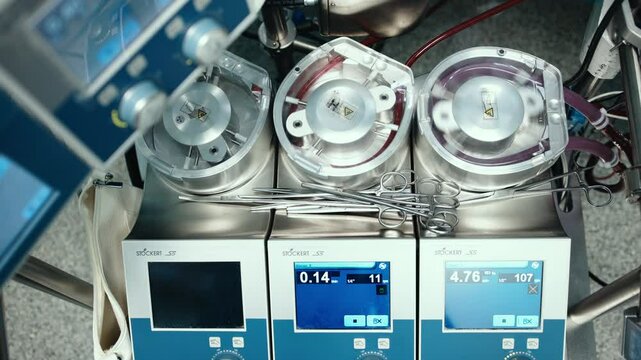 Blood circulation machine in the operating room used during heart surgery. Concept: innovative medical technologies ensuring life support and successful heart surgeries.