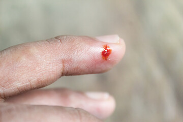 close-up of bleeding cut wound on finger