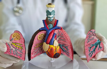 Doctor with smoker and normal lung anatomy disease. Lung cancer, asthma, chronic obstructive...