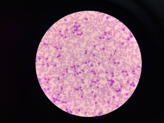 White blood cell