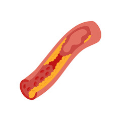 Coronary Artery Disease, Cardiovascular Disease Illustration Icon