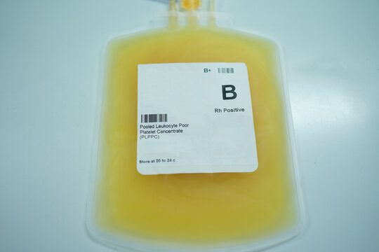 A single platelet bag labeled "Pooled Leukocyte Poor Platelet Concentrate (PLPPC)" with blood type B, Rh Positive. The liquid inside is also platelet concentrate.