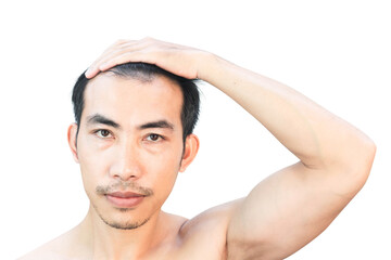 Young man serious hair loss problem for health care medical and shampoo product concept