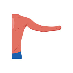 Hand Amputated, Disability Vector Illustration Isolated