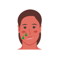 Myasthenia, Gravis, Disability Vector Illustration Isolated