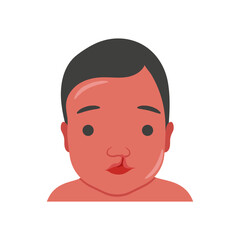 Cleft Palate, Disability Vector Illustration Isolated