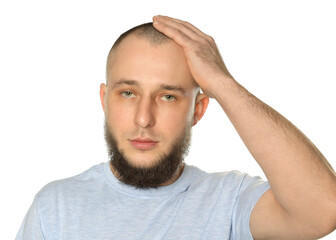 Obraz premium Baldness problem. Man with receding hairline on white background