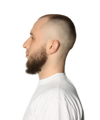 Obraz premium Baldness problem. Man with receding hairline on white background