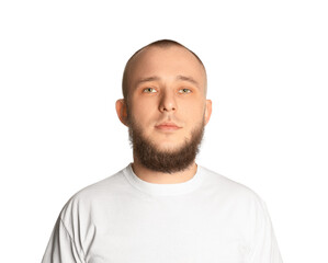 Baldness problem. Portrait of man with receding hairline on white background