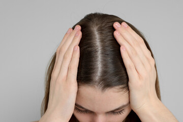 Fototapeta premium Girl with hair loss problem on grey background, closeup