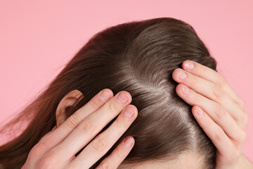 Girl with hair loss problem on pink background, closeup