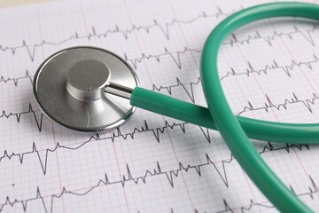 Cardiology. Stethoscope on paper with cardiogram, closeup