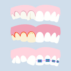 Various dental problems and diseases. Oral problems, caries, tartar, plaque, orthodontic braces, various injuries. Vector illustration