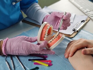 Demonstration of dental braces on a model during an orthodontic consultation