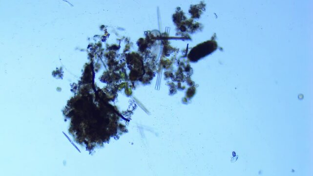 Ciliated Protozoan scavenging in freshwater - 100X
