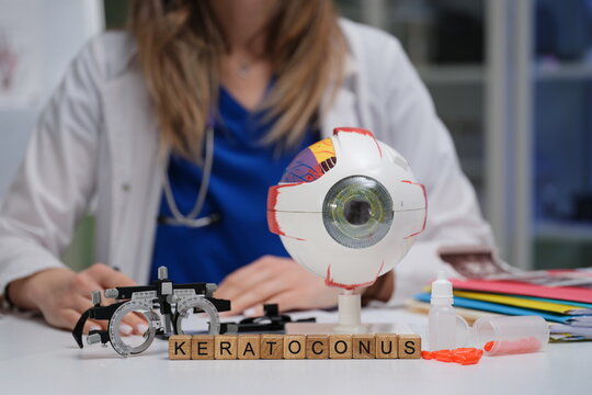 This article presents a comprehensive and detailed look at keratoconus using an anatomical model in a clinical setting