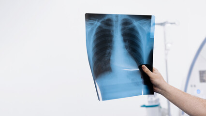 Close-up x-ray scan. Radiologist checking investigating patient lungs on image. Pneumonia, chest pain, coronavirus treatment. No people. White background. Advertising medicine concept. Free copy space