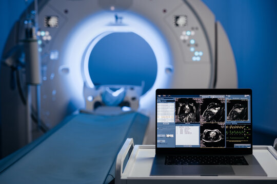 Computed tomography scan mock-up with multiple windows and data. Medical research environment software with CT scan results for computer displays and laptop screens. Banner, advertising medicine