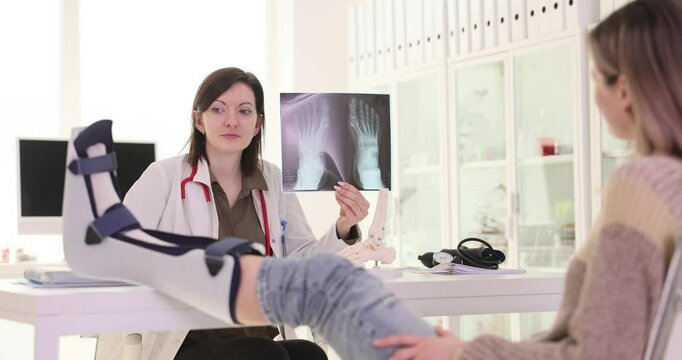 Lady doctor shows X-ray images of foot bones to lady patient with broken leg in cast. Traumatologist informs injured woman about recovery process