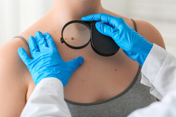 Doctor examining mole of young woman in clinic, closeup