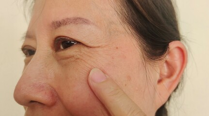 Obraz premium Portrait the wrinkle and Flabby skin, Flabbiness and lines beside the eyelid, dark spots and blemish on the face of the woman health care and beauty concept.