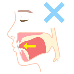 正しいミューイングの方法　適正な舌の位置と誤った舌の位置 © koti
