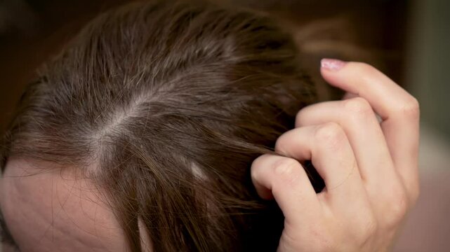 Close up woman hair, split ends frizz, thinning or dandruff. Problems dryness hair loss or oily scalp. Close up female hair revealing concerns breakage, lack of shine,or scalp irritation