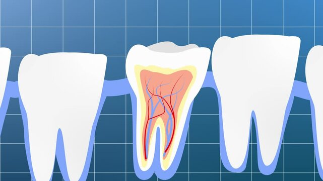 Sick tooth against healthy background. Teeth in gum. Dental treatment.