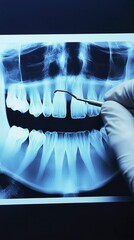 Dental X-Ray Examination Close-up of Teeth and Dental Instruments
