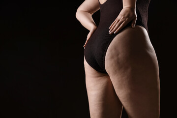 Woman with cellulite problem on black background, closeup. Space for text