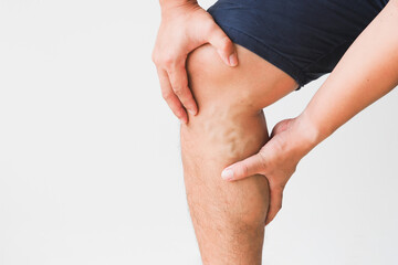 Man leg with varicose veins on white background.