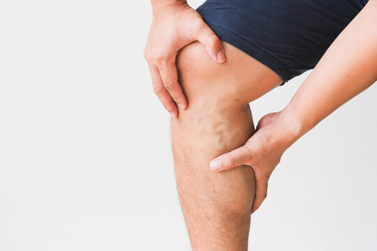 Man leg with varicose veins on white background.