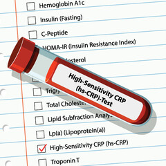 Obraz premium Medical Blood Test Illustration
